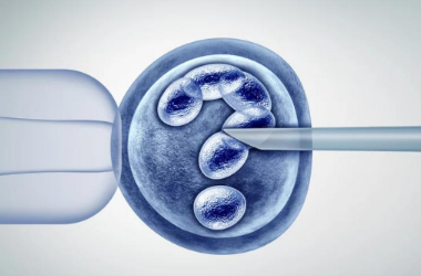 卵巢扭转是什么原因导致的？